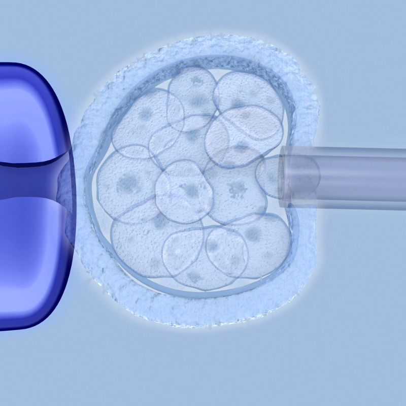 PGT-M - Preimplantation Genetic Testing for MonogenicSingle Gene Defects